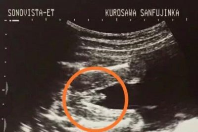 ​八个月胎宝宝有多大