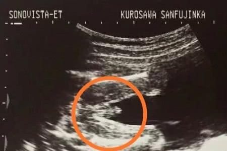 八个月胎宝宝有多大