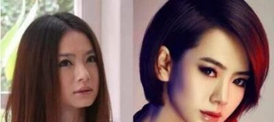 ​整容脸僵慢慢会恢复吗(整容脸为什么会显得僵硬)