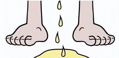 ​尿分叉是什么原因